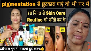 10 साल पुरानी झाइयों को ठीक किया है! मैंने इस आसान से*SkinCare Routine*को फॉलो करें 100% Effective