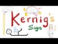 kernig sign meningitis neurology physical exam