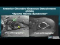 MRI Online: Hip Pathology, Part II