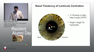 RAD 05 19 17 Moshifar Early Clinical Experiance With SMILE