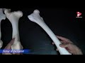 Comparative anatomy of the Femur Bone