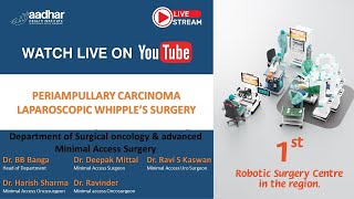 LAPAROSCOPIC WHIPPLE'S SURGERY FOR PERIAMPULLARY CARCINOMA