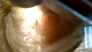 Vacuum Deaerating
