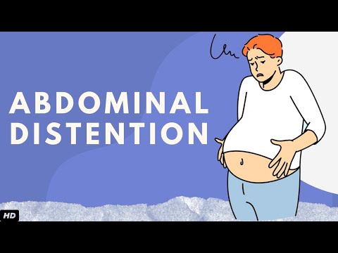What causes J shaped stomach?