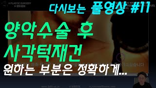 양악수술 후 사각턱재건 / 수술을 계획할 때 본인이 원하는 방향을 정확하게 말씀 주세요.  [다시 보는 풀영상 #11]