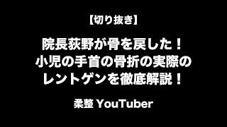 当院の整復から癒合までのクオリティ　切り抜きシリーズ