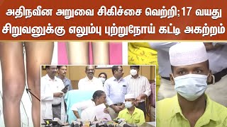 Bone Cancer | அதிநவீன அறுவை சிகிச்சை வெற்றி ;17 வயது சிறுவனுக்கு எலும்பு புற்றுநோய் கட்டி அகற்றம்