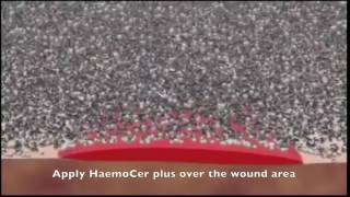 HaemoCer Mechanism on wounds