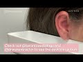 water device painlessly removes earwax art insider