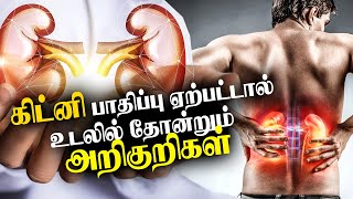 சிறுநீரக பாதிப்பு ஏற்பட்டால் உடலில் இந்த 8 அறிகுறிகள் தென்படும் | #kidneydisease