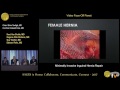 Video Face-Off Panel: Minimally Invasive Inguinal Hernia Repair--Introduction 