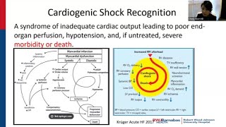 Time is Myocardium: Cardiogenic shock care pathways and early mobilization of a shock team