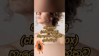 දෙයියන්ගෙ ලෙඩේ ගැන හරියට දැනගෙන ඉමු නේද.#chickenpox#papol#how prevent chickenpox#symptoms chickenpox