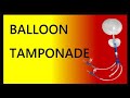 Balloon Tamponade | Uterine Balloon Tamponade | Bakri Balloon | OSCE and TOACS  Station