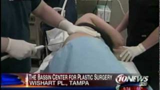 Live Aqualipo® Surgery Performed on Tampa Bay WTSP's 10 News - Part 2