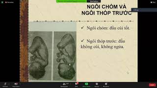 Chẩn đoán ngôi thế kiểu thế