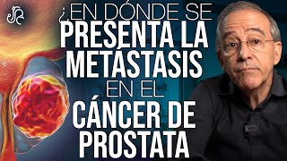 CÁNCER De PRÓSTATA AVANZADO, Prevención - Oswaldo Restrepo RSC