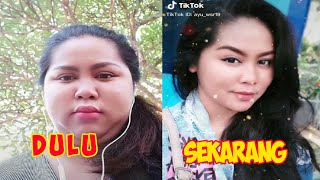 Dulu Dan Sekarang || Tiktok Viral Perubahan Jelek Sampai Cantik