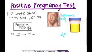 Sex Education 3 - Teen Pregnancy