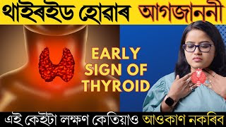 থাইৰইড হোৱাৰ এই কেইটা লক্ষণ আপোনাৰ গাত দেখা দিছে নেকি || Thyroid Symptoms || Ponkhi Sharma