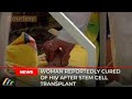 Woman reportedly cured of HIV after stem cell transplant