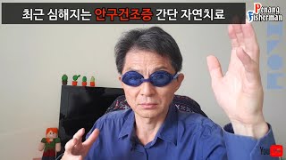 안구건조증 간단히 자연치료]👁이 건강꿀팁 따라만 하세요