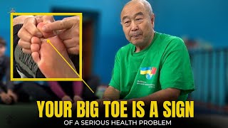 The Truth About Your Big Toe - Warning Signs and Conditions it May Indicate