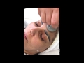 Skin Rejuvenation Treatment: OxyGeneo 3-in-1 | Peptide Peel | Dermaroller Mask