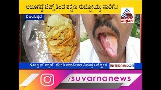 ಚಿಪ್ಸ್ ತಿಂದು ನಾಲಿಗೆ ಸುಟ್ಟುಕೊಂಡ ಯುವಕ ! Youth's Tongue Burns After Eating Chips