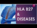 USMLE Step 1 Immunology - HLA-B27 & Associated diseases with Step 1 questions.