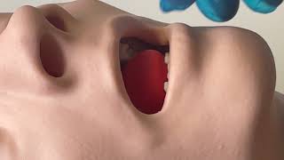 AirSim Difficult Airway