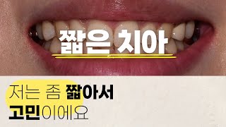 [짧은치아]짧아서 좋은건 아래턱 뿐? 치아가 짧아서 고민인 사람들 여기 모여라! 길어서도 고민이지만 짧아서도 고민인 치아! 그 해결 바이블이 여기 세시간치과에!