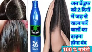 डैंड्रफ को 2 दिनों में कैसे खत्म करें |  बालों का झड़ना होगा जड़ से खत्म|Dandruff🌸