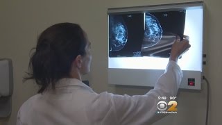 Dr. Max Gomez: Mammograms