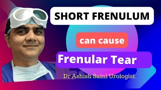 Short Frenulum leading to Frenular tear ?? All you need to know