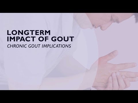 What is the long-term treatment for gout?