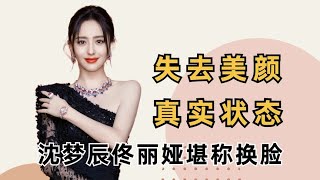 明星失去美颜真实状态一目了然，王源老了十岁，沈梦辰判若两人