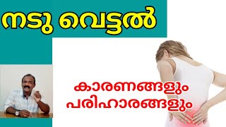 നടു വെട്ടൽ| Locked Facet Joint| Meniscoid entrapment