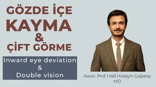 Gözde içe kayma ve çift görme (Esotropia and double vision)