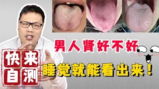 男人肾好不好，睡觉几个习惯告诉你，占一个都要好好养肾了！   【舌诊案例分析】