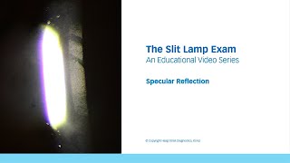 The Slit Lamp Exam – Episode 7,  Specular Reflection