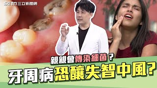 掉一顆牙就提高失智風險？醫師揭密「牙周病害全身」嚴重恐導致中風.失智｜親親會傳染細菌？牙醫專家破解口腔內真相｜醫點不誇張｜祝你健康