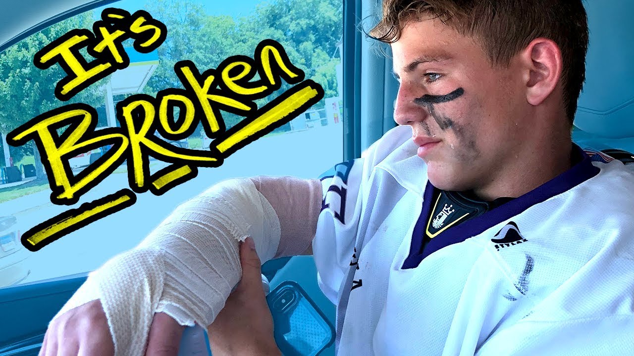 How I Broke My Arm - YouTube