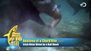 Shark Chomps Man's Leg | Shark Week's 25 Best Bites -- Shark Week 2012