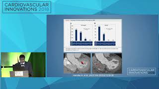 CVI2018 Session: CT imaging for TAVR beyond area and perimeter - Joao Cavalcante, MD