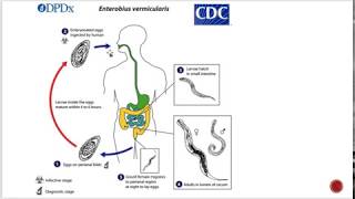 Enterobius vermicularis