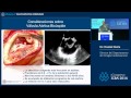 Resultados a largo plazo de la plástica valvular aortica y mitral Dr Daniel Navia