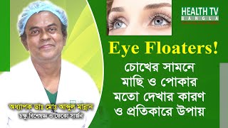 Eye Floaters (আই ফ্লোটার্স) | চোখের সামনে মাছি ও পোকার মতো দেখা | Eye Problems \u0026 Treatment Bangla