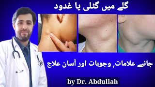 Swollen Lymph Nodes In Neck Symptoms, Causes \u0026 Treatment | Lymphadenopathy | Gale Ki Gilti Ya Ganth