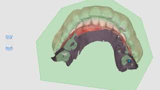 Features for Occlusion (ENG)